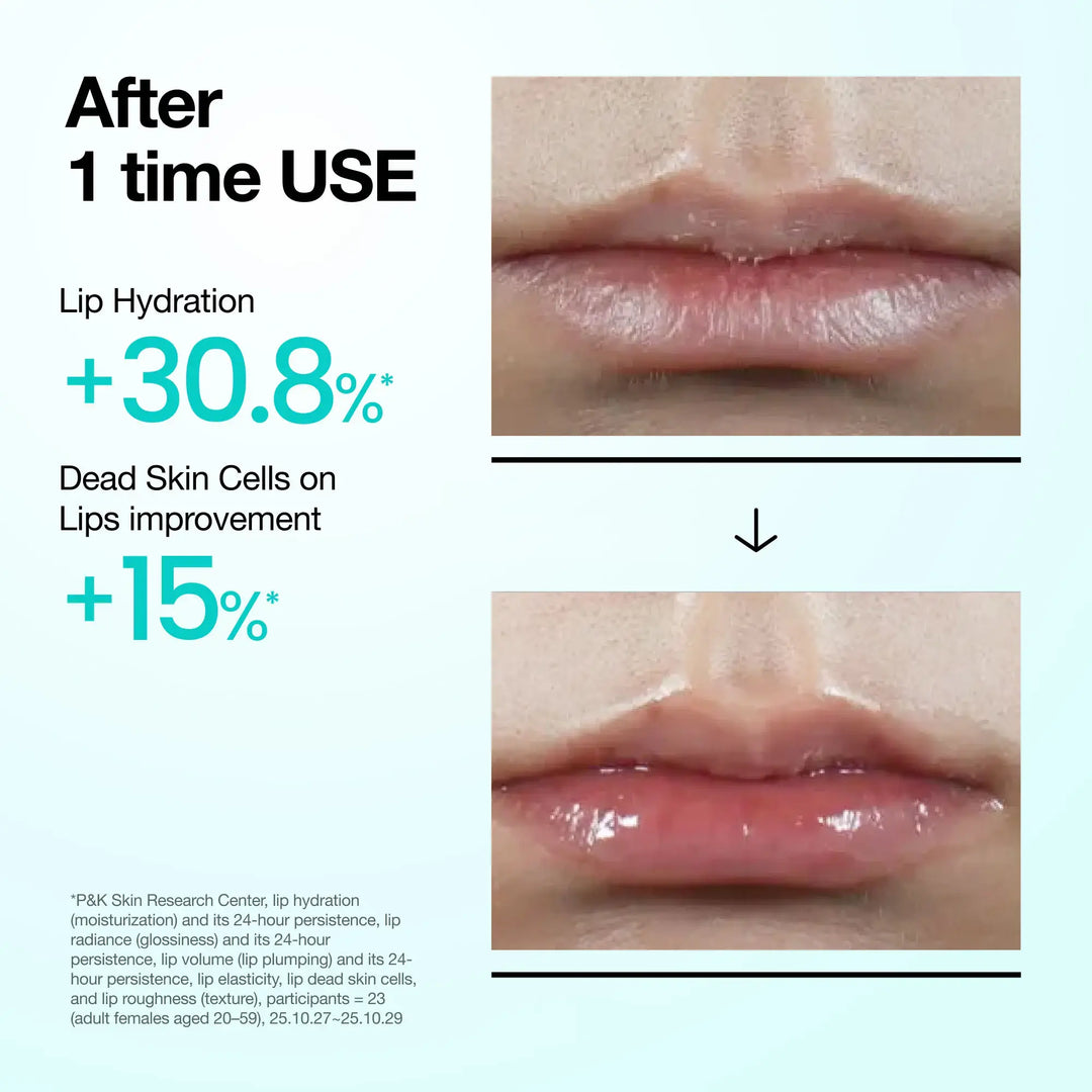 Anua PDRN Lip Serum Anua