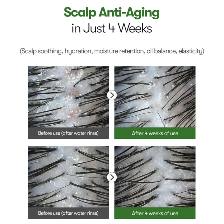 VT Cosmetics  Reedle Shot Hair Ampoule 100 15ml